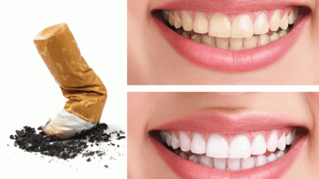 Journée sans tabac : 5 bonnes raisons d'en finir avec la cigarette