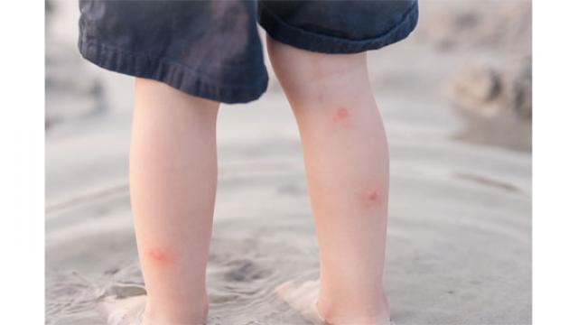 Moustiques : comment se protéger efficacement